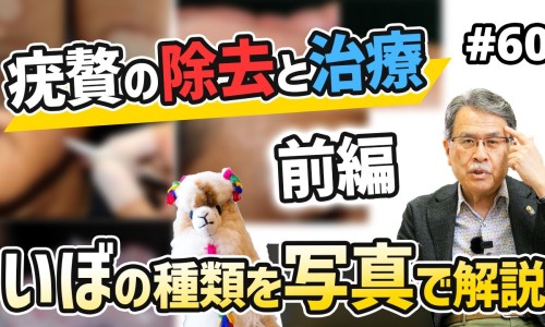 【tct检查和活检一样吗】tct和活检结果差多少 - tct和活检有什么区别网
